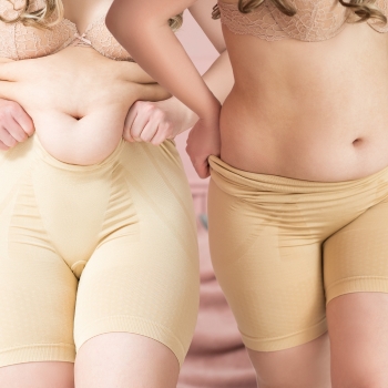 tummy tuck before and after
